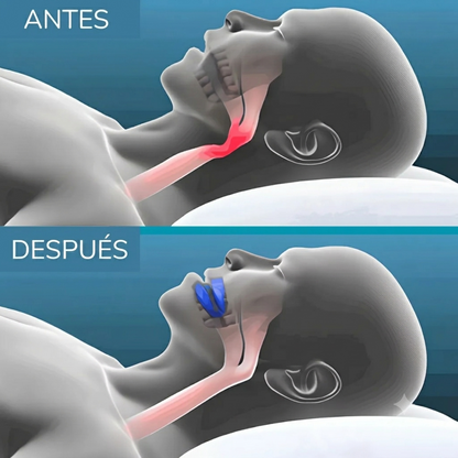 Silenzia™ Dispositivo Bucal Anti Ronquidos [Sueño Profundo y Noches en Silencio]
